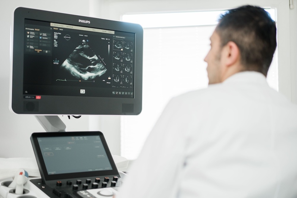 Echokardiografie beim Herz-Check-up in der Kardiologie D&uuml;sseldorf